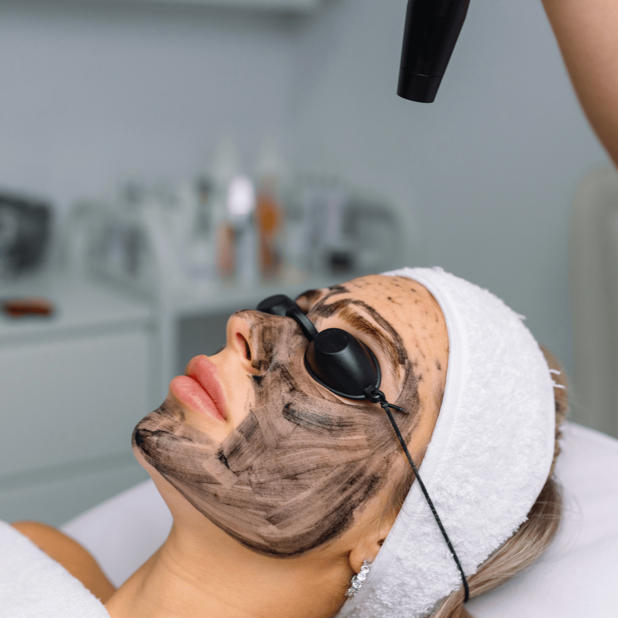 Close-up of a female client wearing protective eye shields undergoing a carbon laser facial peel for oily, congested skin and pore minimization.