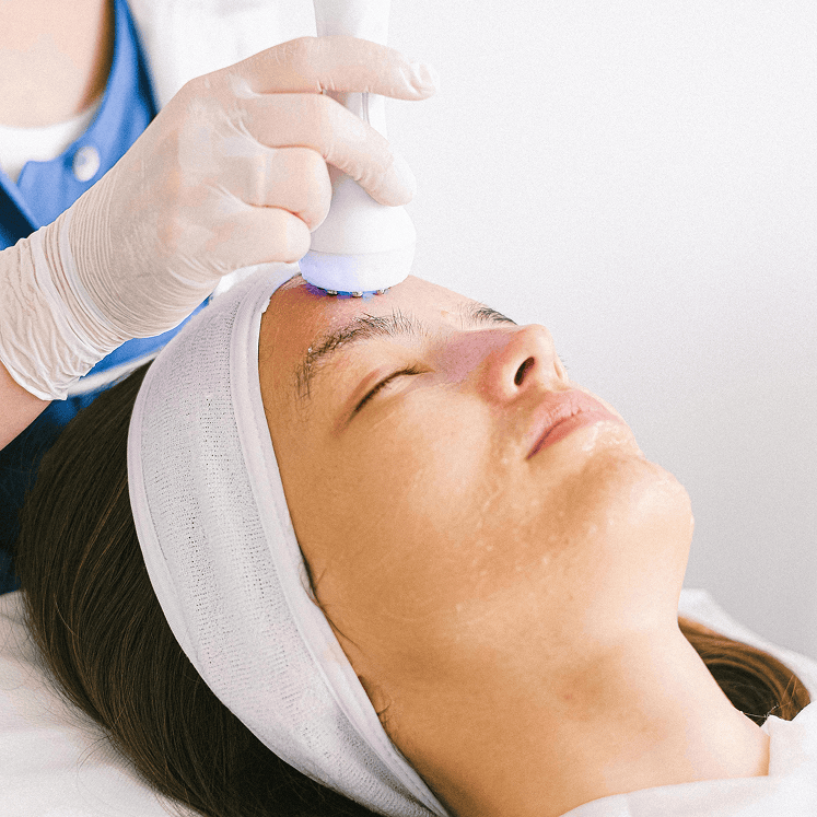 Client receiving RF radio frequency skin-tightening treatment on her forehead with a blue light wand.