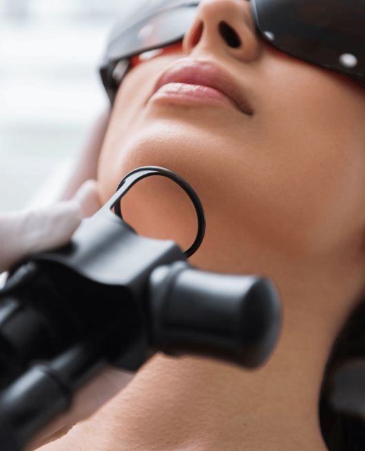 C02 Laser Resurfacing