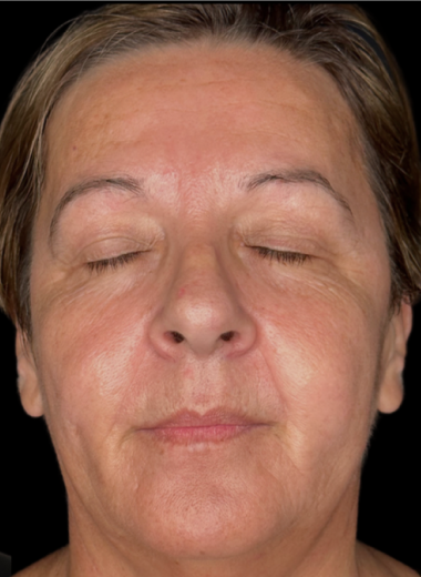 After - skin before after 5