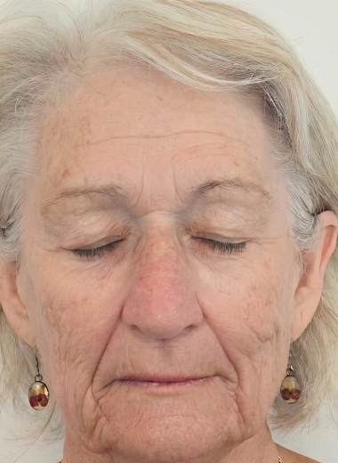 After - skin before after 15-3