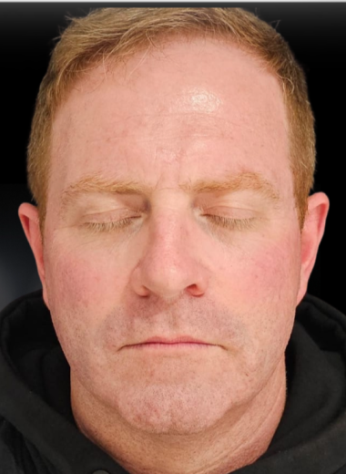 After - skin before after 6