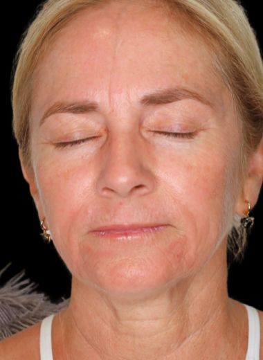 After - skin before after 8