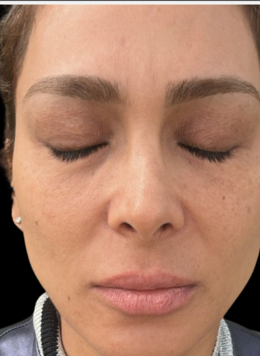 After - skin before after 10