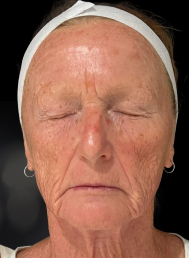 After - skin before after 12