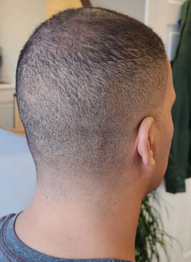 After - Hair before after 7