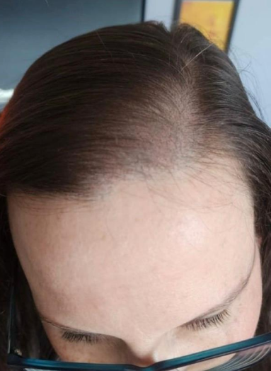 After - Hair before after 8