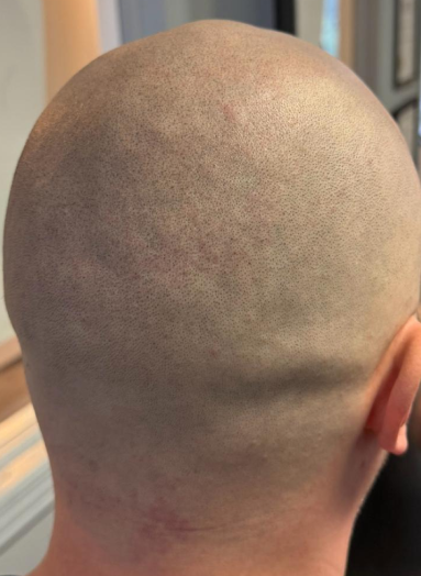 After - Hair before after 9