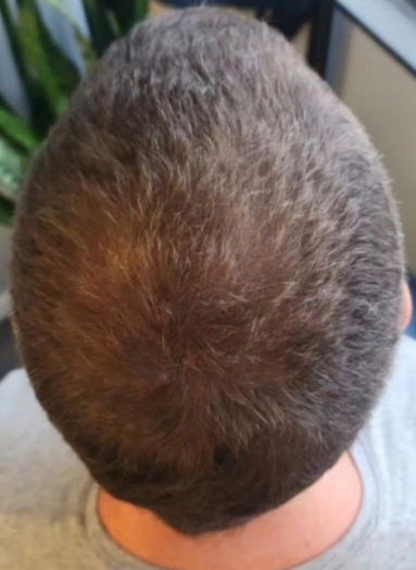 After - Hair before after 10