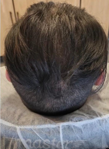 After - Hair before after 6
