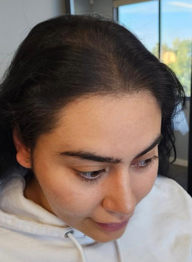 After - Hair before after 6