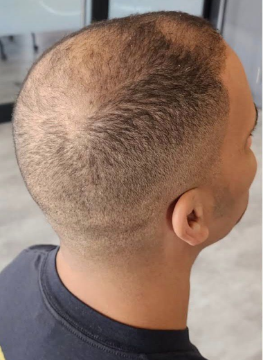 Before - Hair before after 7