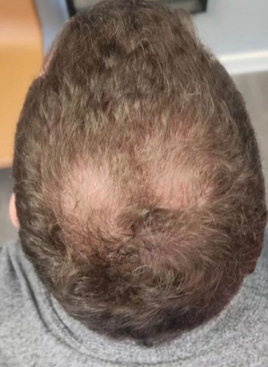 Before - Hair before after 10