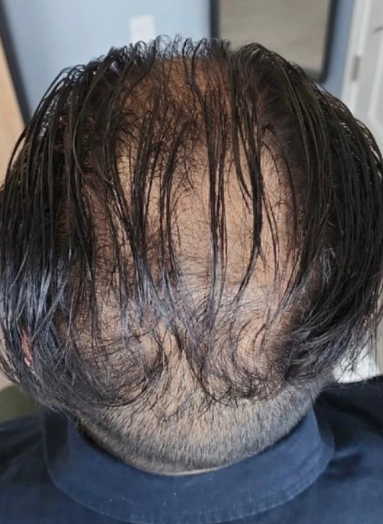 Before - Hair before after 6
