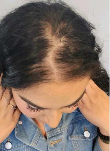 Before - Hair before after 6