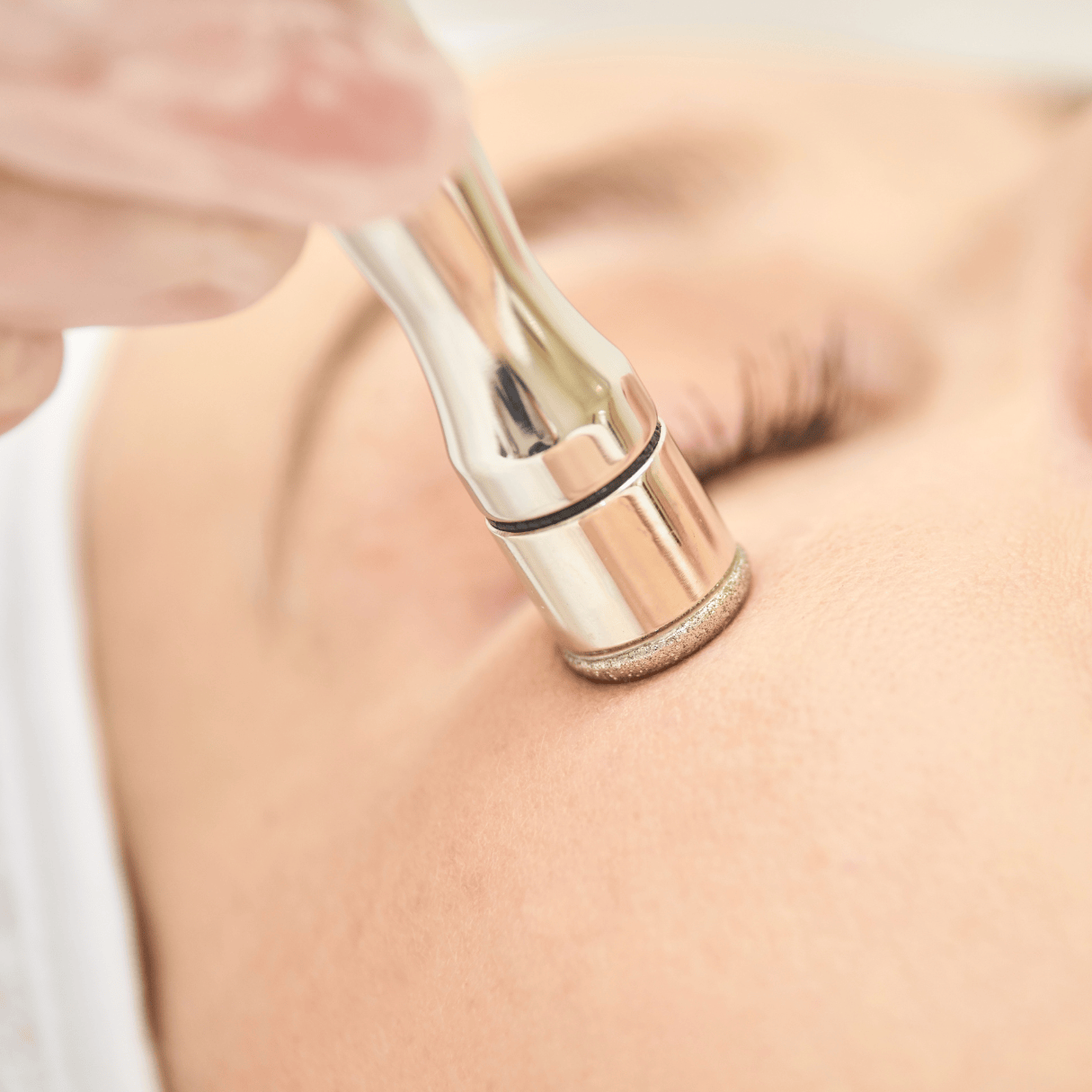 Microdermabrasion skin resurfacing treatment targeting blackheads, enlarged pores, and uneven skin tone.