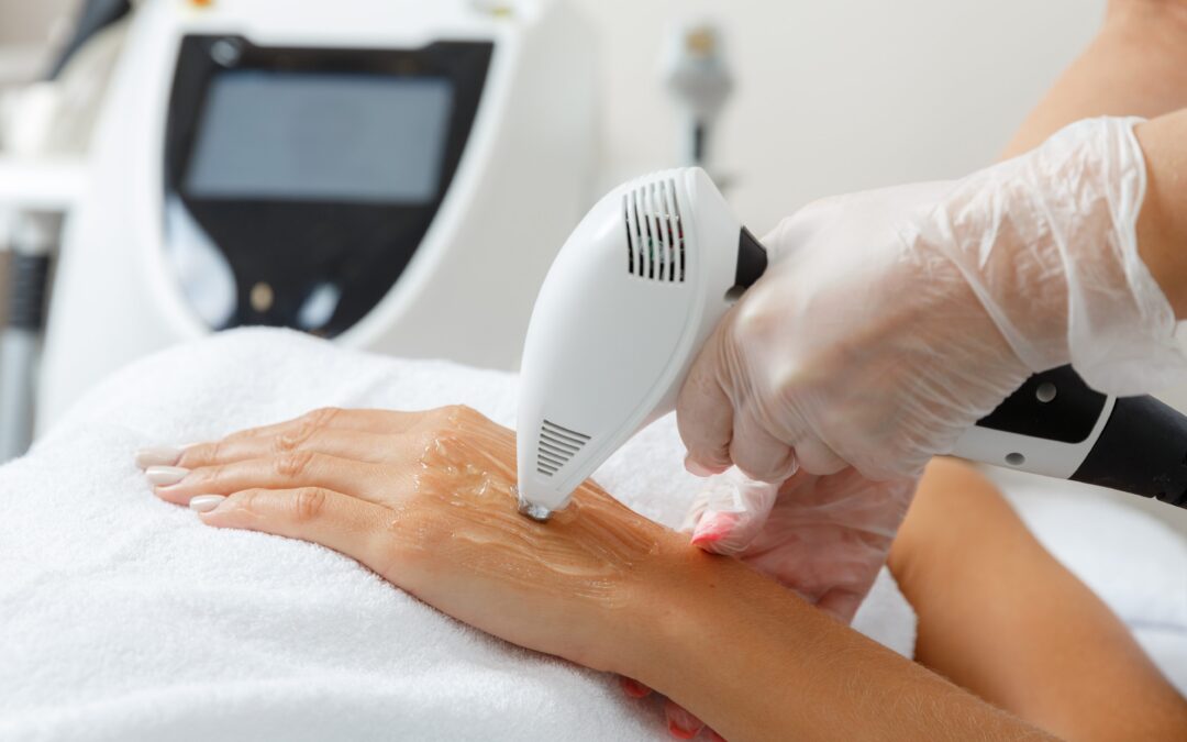 Skin IPL