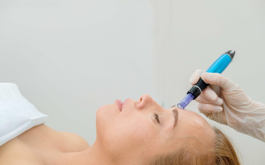Skin Needling