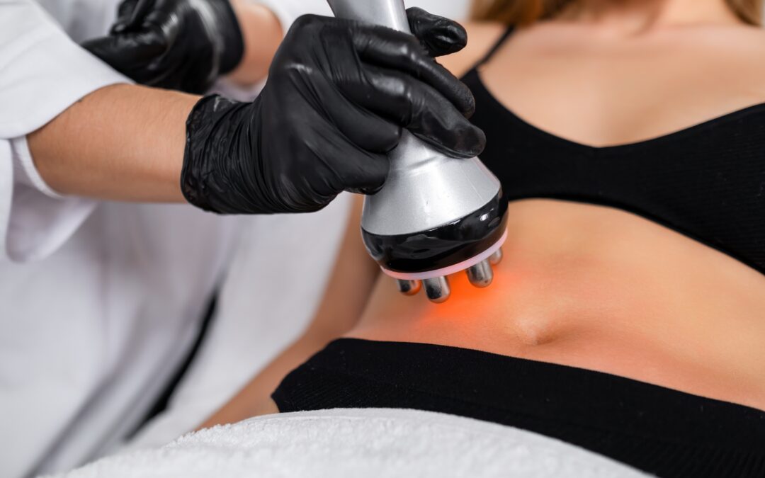 RF Body Tightening