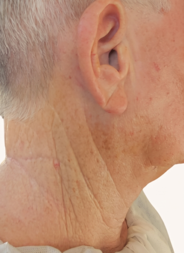 After - skin before after 26