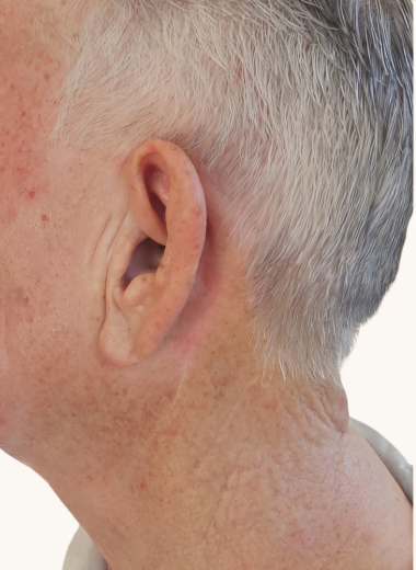 After - skin before after 24