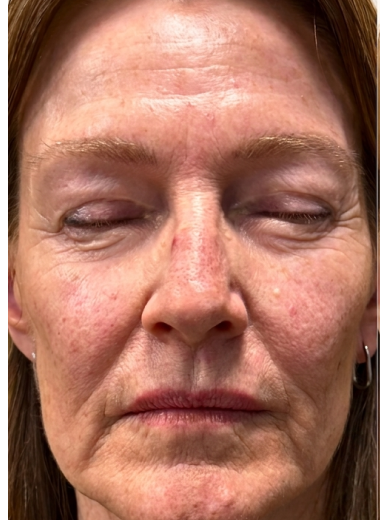 Before - skin before after 27